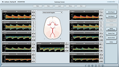 Intracranial Stenosis Screen