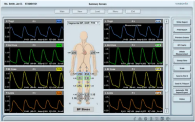Segmental Pressures and PVR Explained