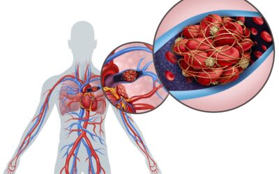 Emboli Detection with Dolphin TCD: Setting the Gold Standard