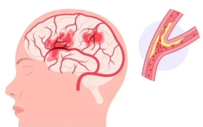 Dolphin TCD vs. Other Neurovascular Tests